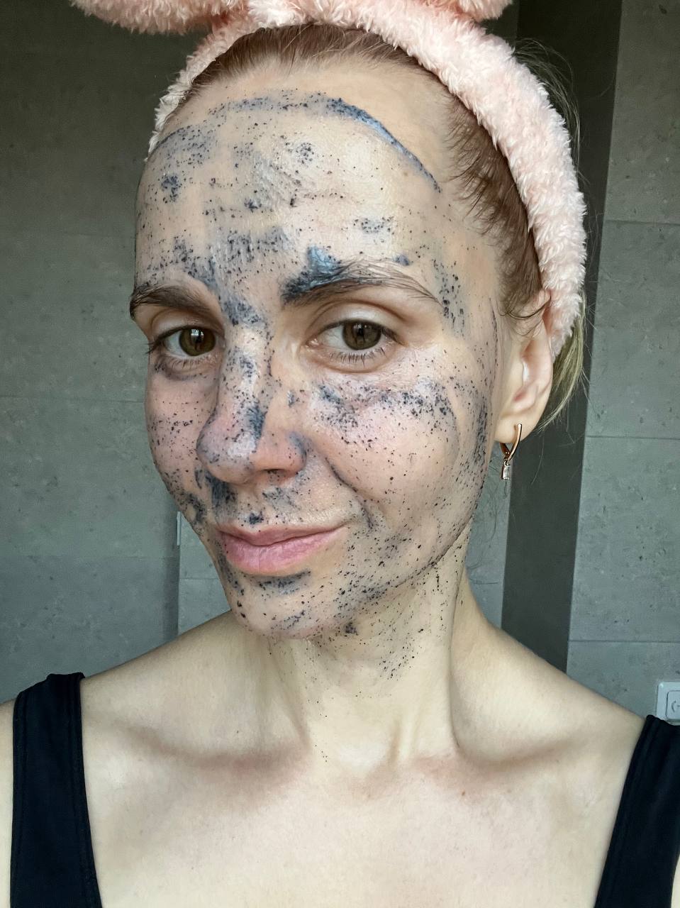 САЛОННЫЕ МЕТОДЫ БОРЬБЫ С ПИГМЕНТАЦИЕЙ