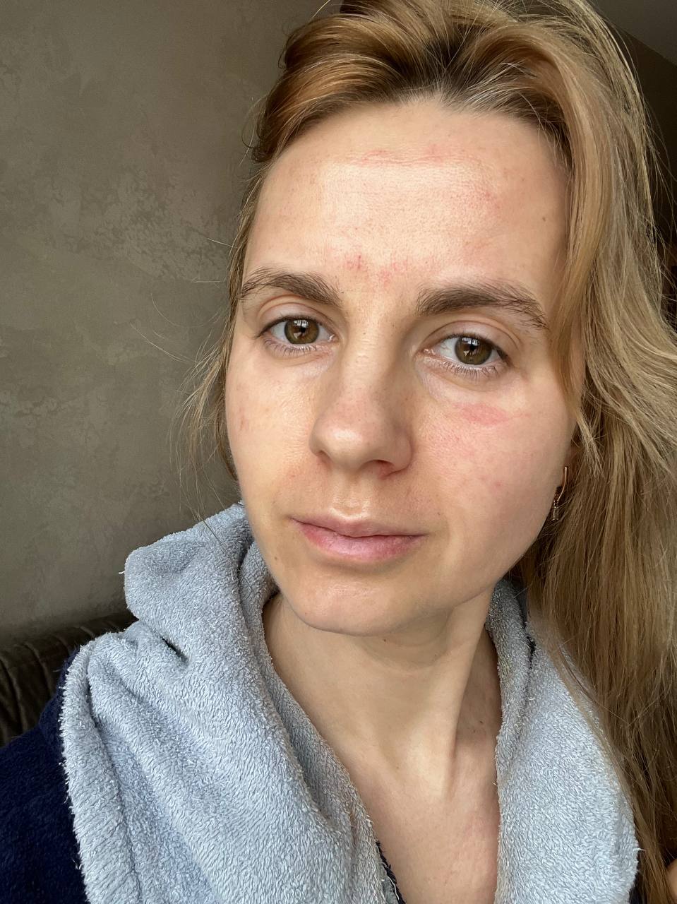 Лучшие и худшие процедуры по уплотнению кожи